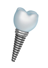 mini dental implants dentist Derry NH and Salem NH
