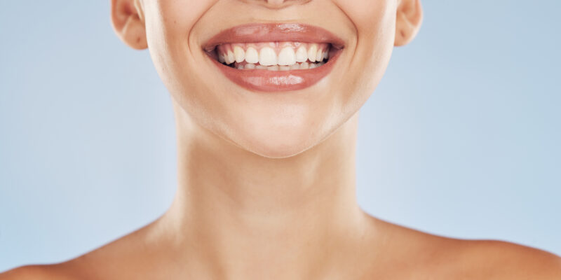 Look Younger With A Smile Makeover