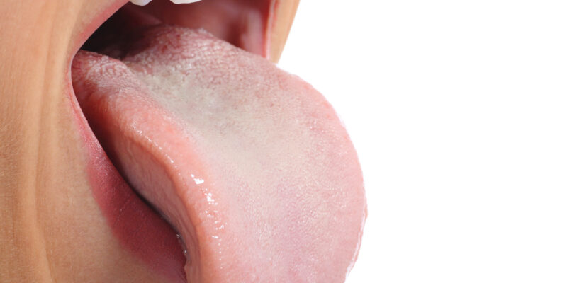 Woman's open mouth showing tongue extended, white teeth visible, against white background.