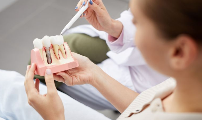 Dental Implants in US-Vanguard Dental Group