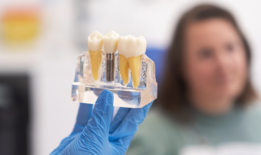 Dental Implant in Derry NH-Vanguard Dental Group