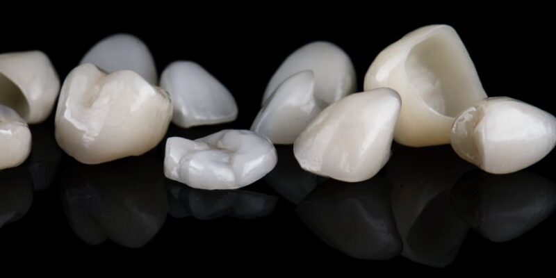 dental crowns