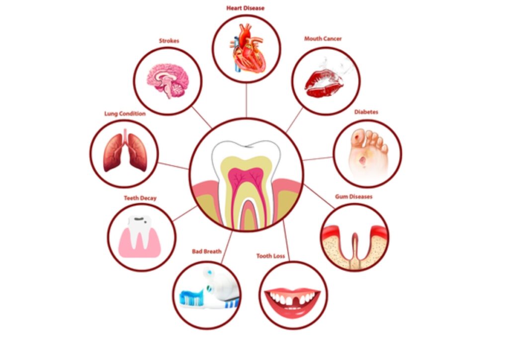 Family Dentistry in Derry