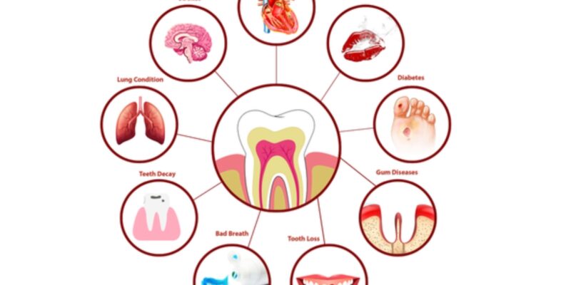 Family Dentistry in Derry