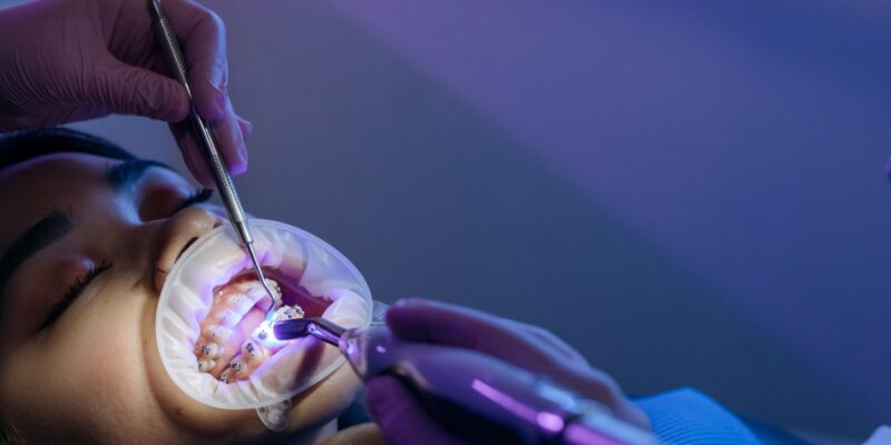 Sedation Dentistry | How Does Sedation Dentistry Work for Kids