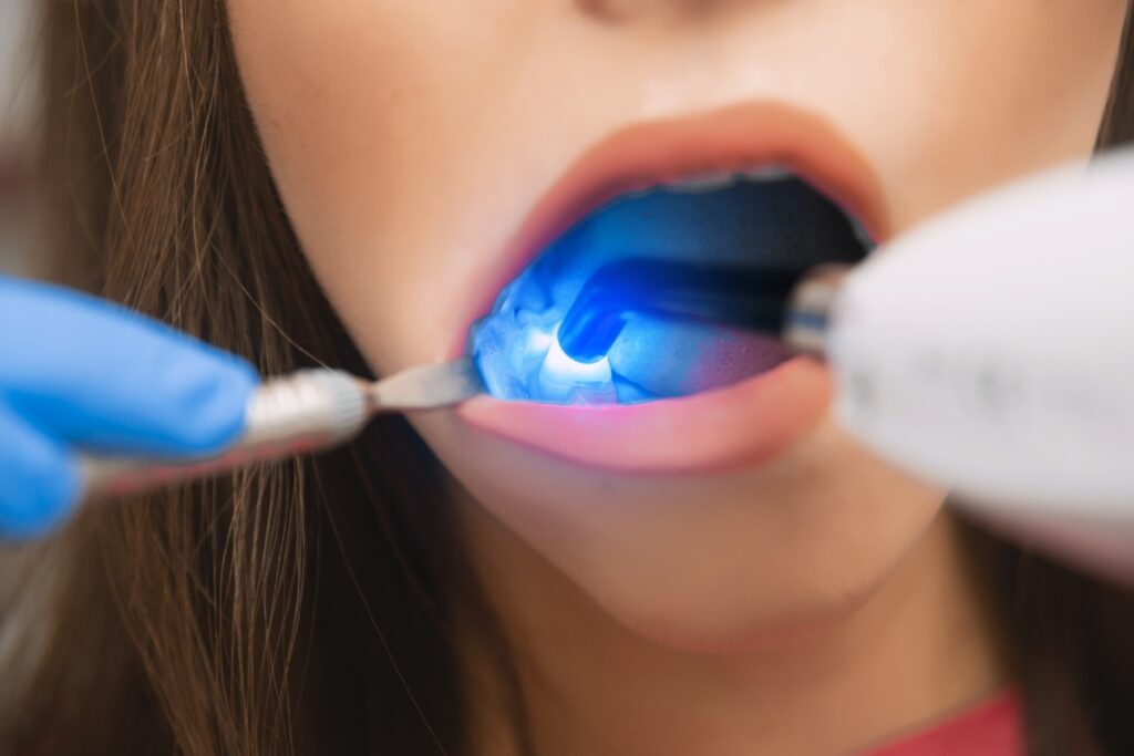 Laser dentistry | Laser Dentistry For Teeth Whitening