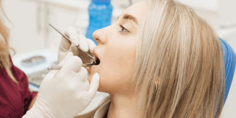 How Often Should You Go to the Dentist?