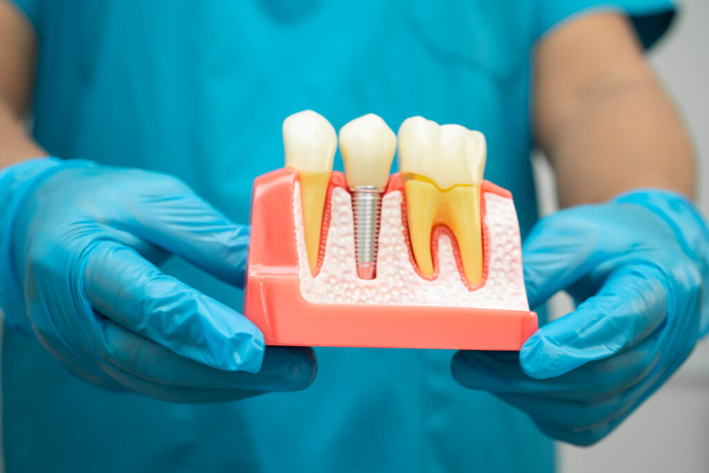 Is Getting a Dental Implant Painful?