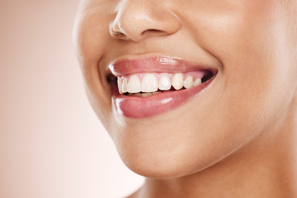 Why Choose a Cosmetic Dentist for Your Smile Makeover?