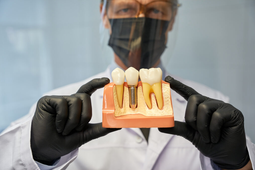 Are Dental Implants Right for You? What to Consider