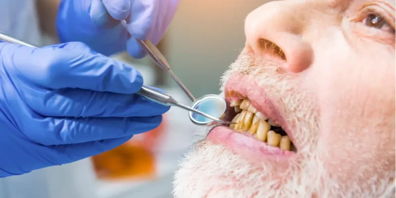 Brighten Yellow Teeth Naturally at Home